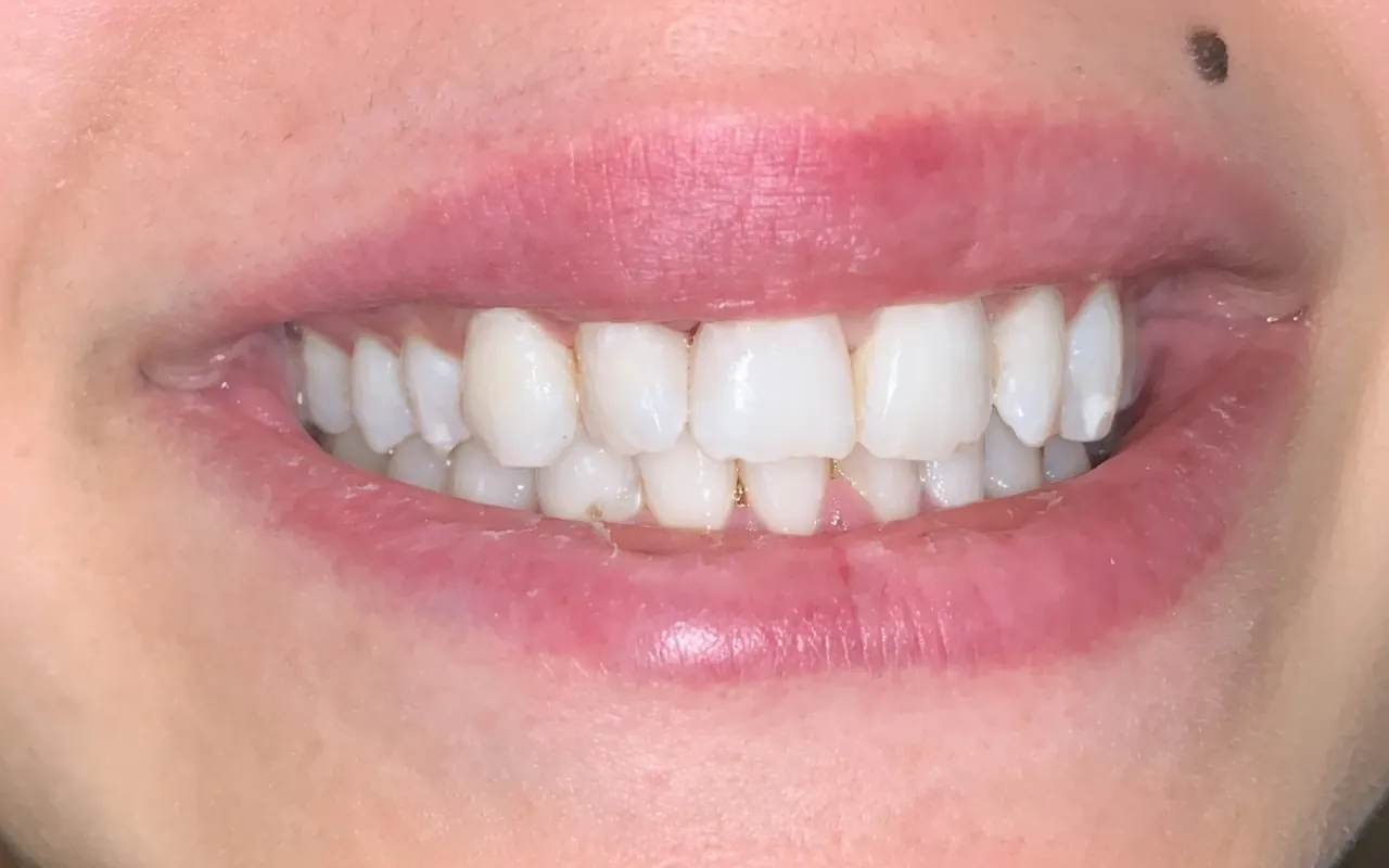 2CDental — estetică dentară