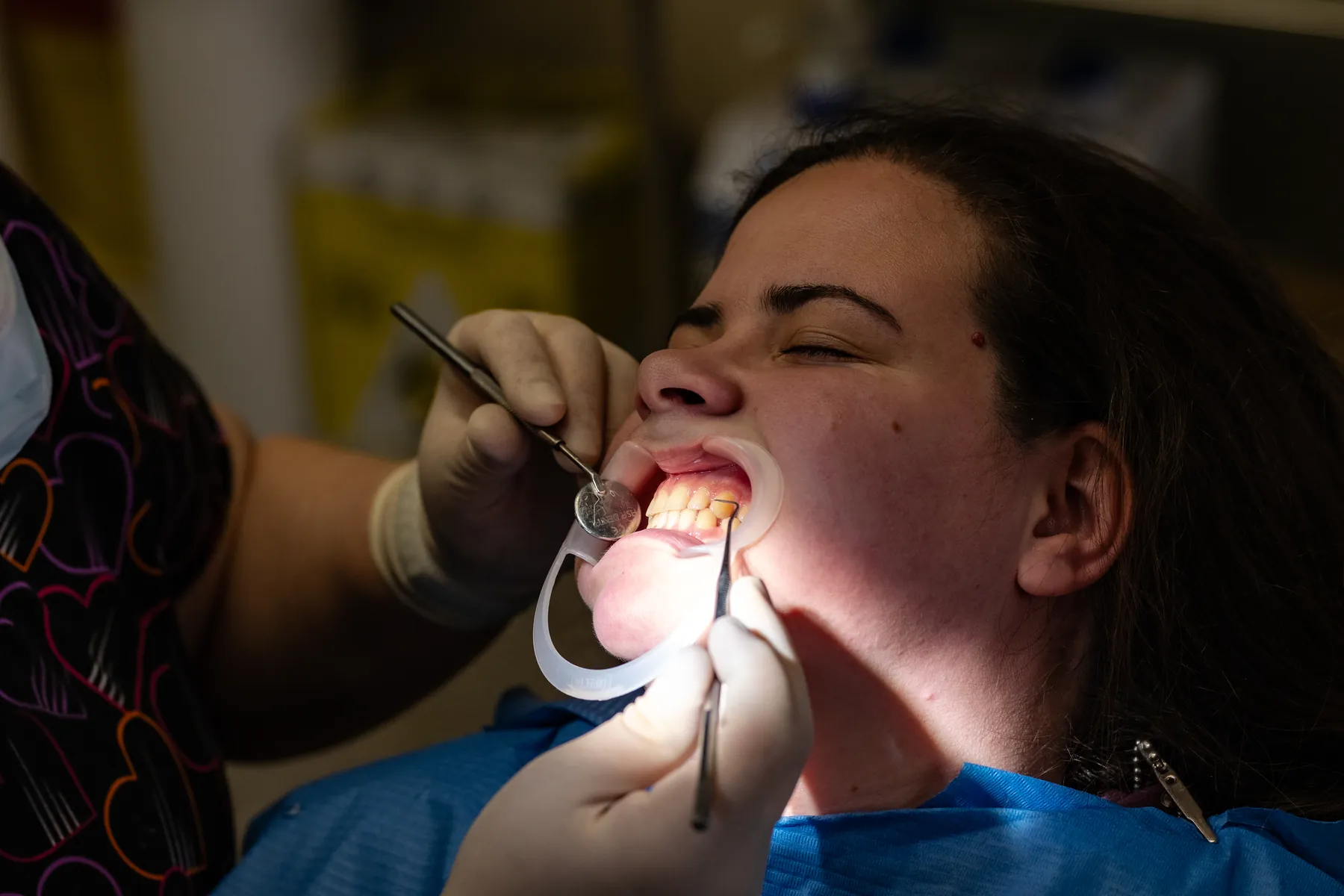 2CDental — imagine clinică și tratament